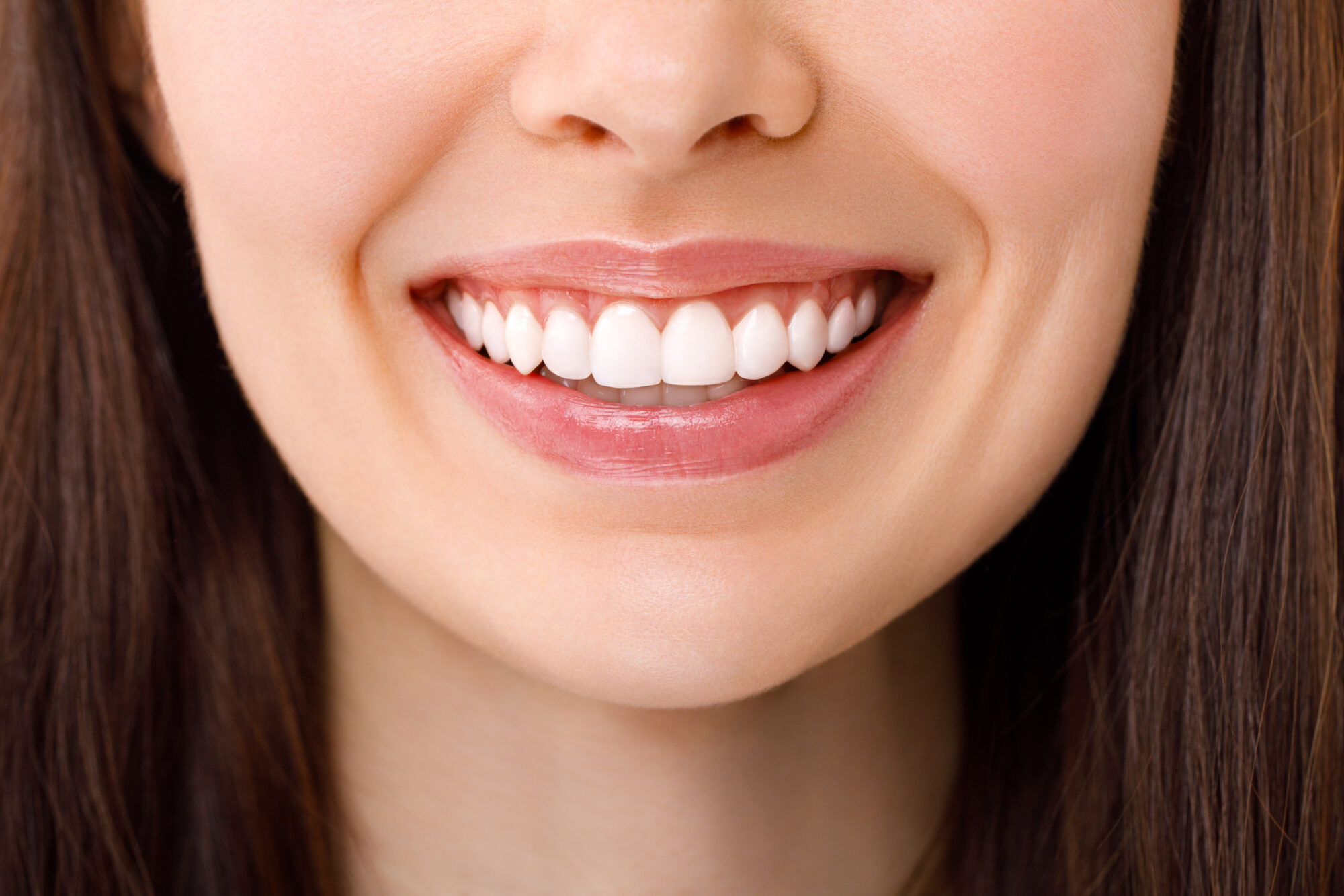 Composite Bonding