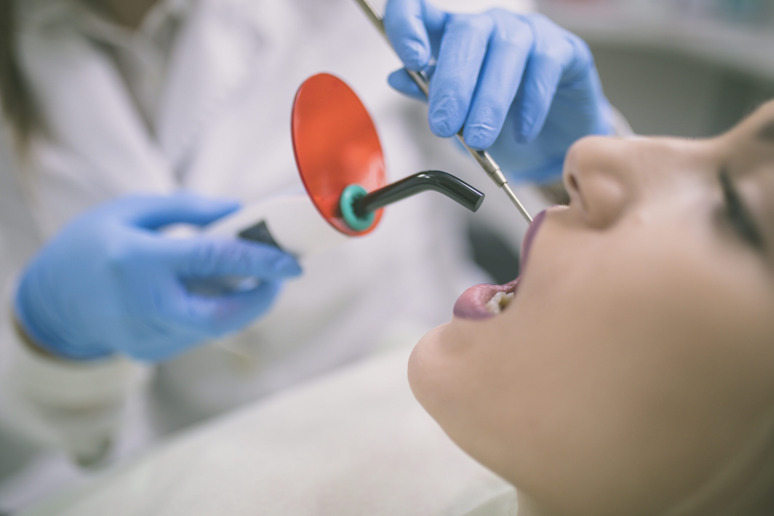 Composite Bonding