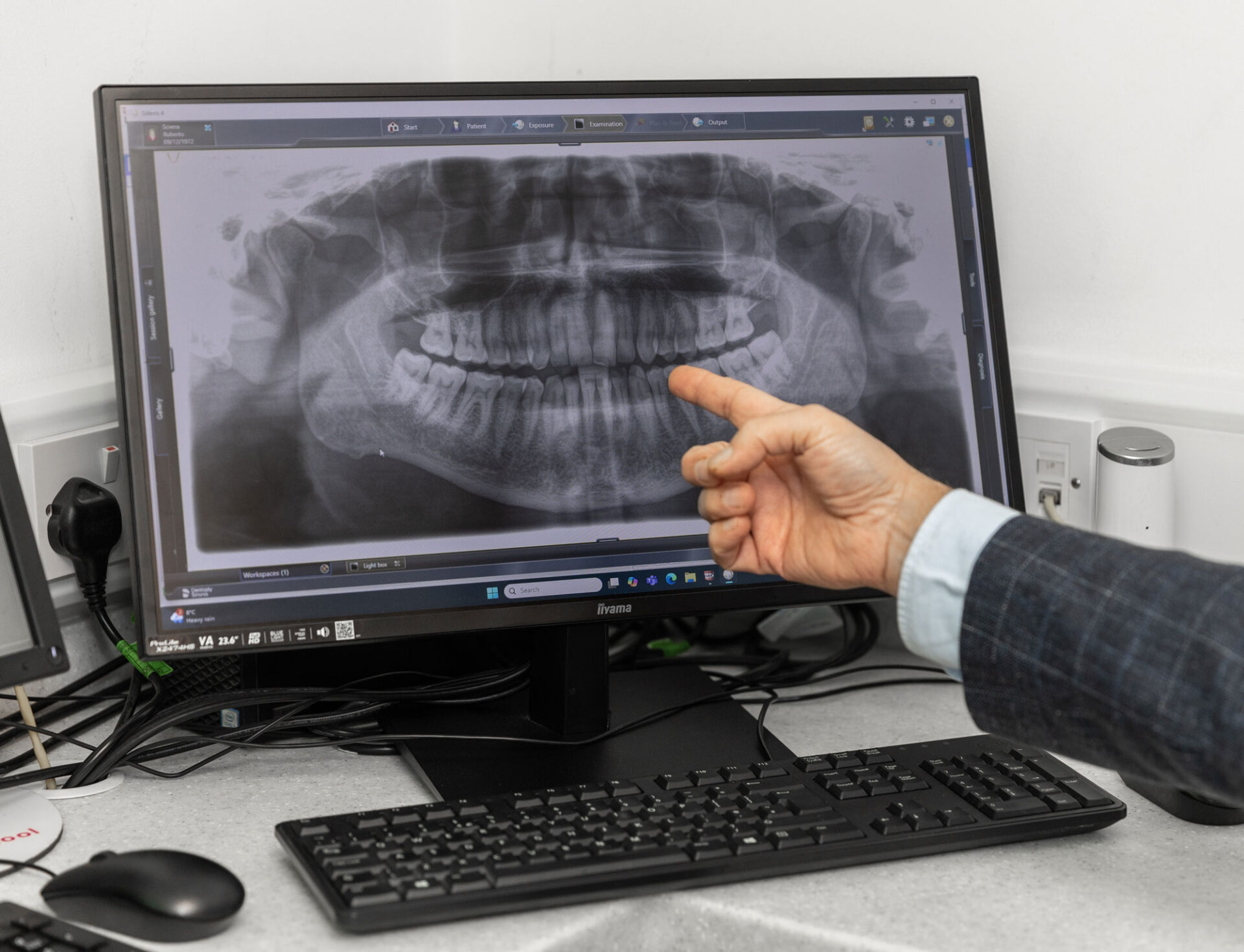 OPG x-rays